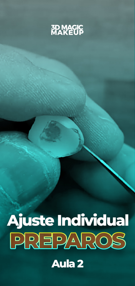 Capas Aulas - Ajuste Individual dos Preparos copiar