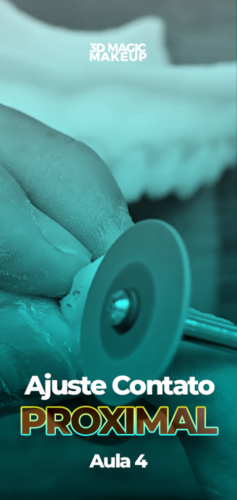 Capas Aulas - Ajuste do Contato Proximal copiar